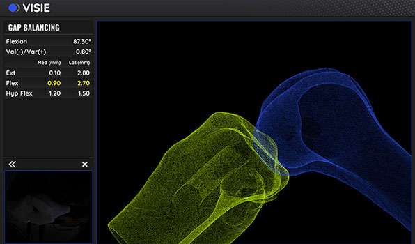 Visie screen